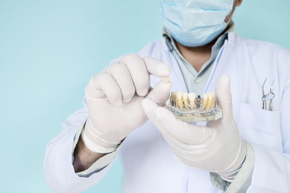 Implanty zębów Katowice